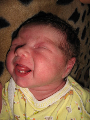Ребенок родился с зубами фото