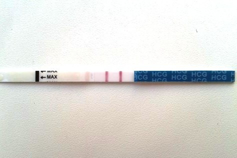 От таблеток до рака: 5 причин, когда на тесте две полоски, но беременности нет